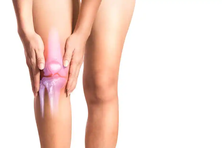 Knie Reha bei Arthrose: Darstellung des Kniegelenks Knie Reha bei Arthrose: Darstellung des Kniegelenks